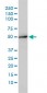 ACY1 Antibody (monoclonal) (M01)
